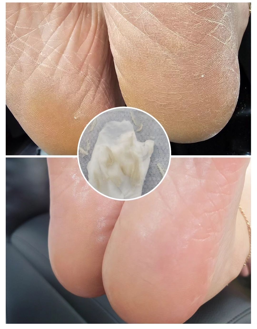 땅콩네일 대표 이미지