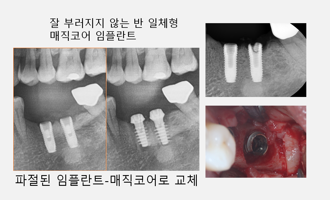덴타피아치과의원