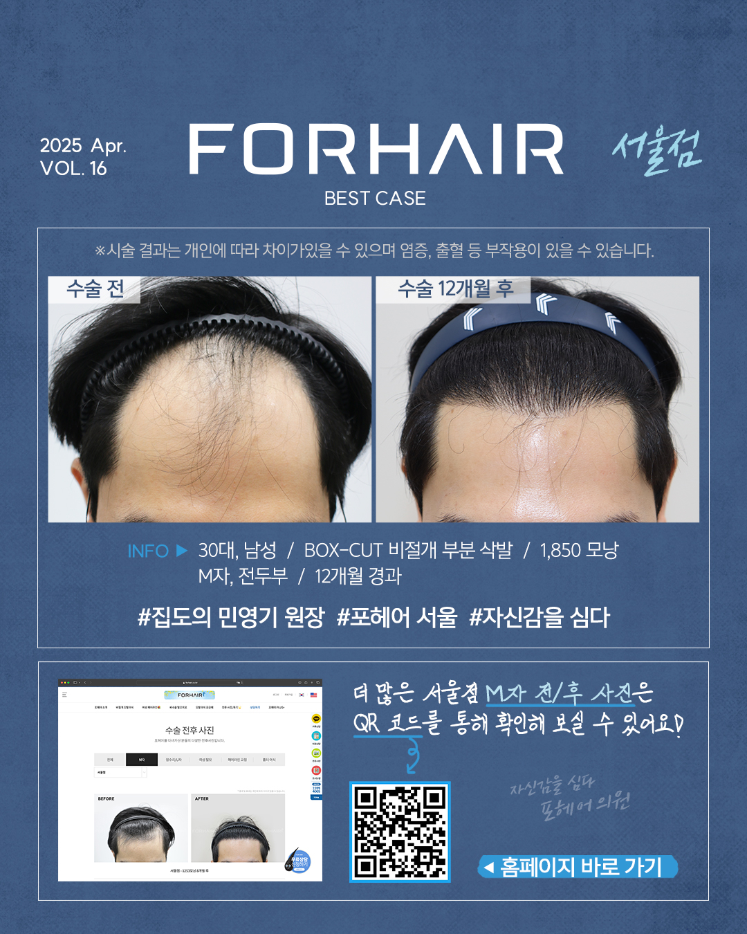 포헤어의원 서울점 대표 이미지