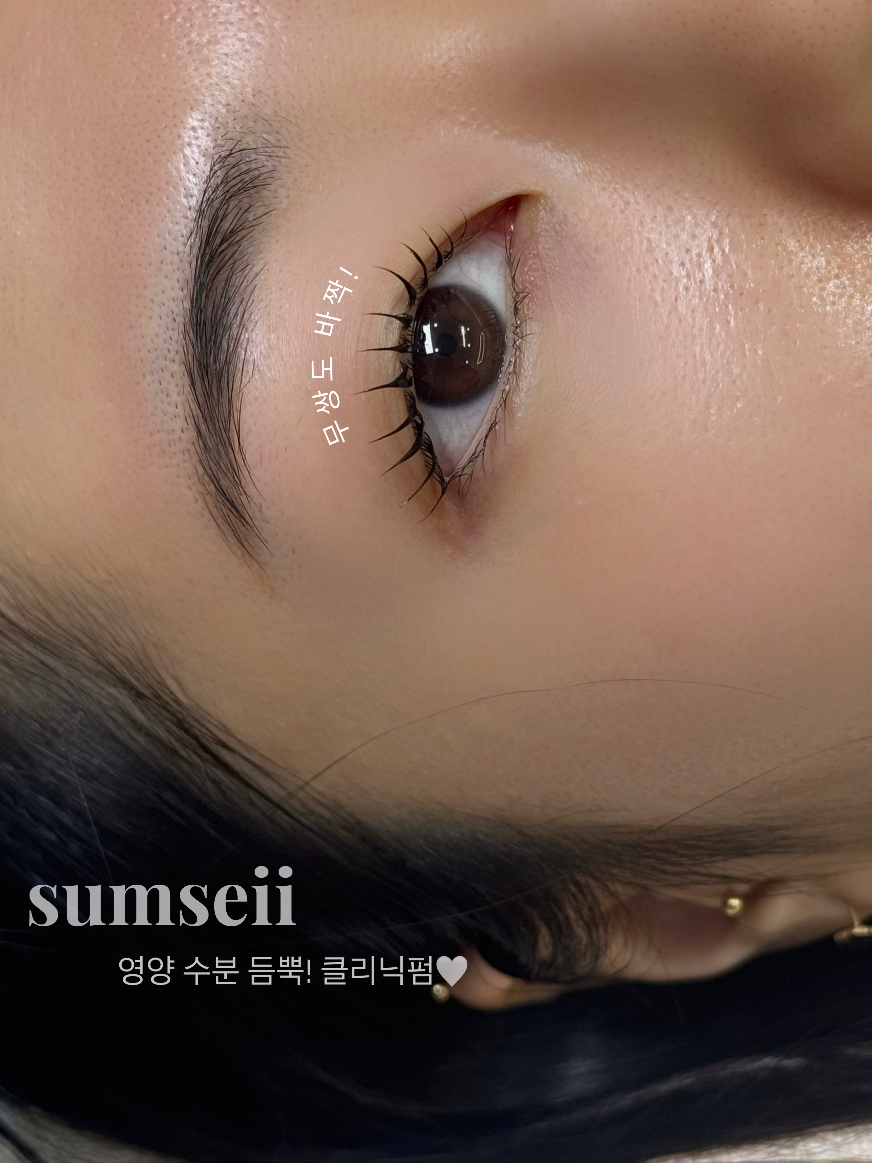 섬세희