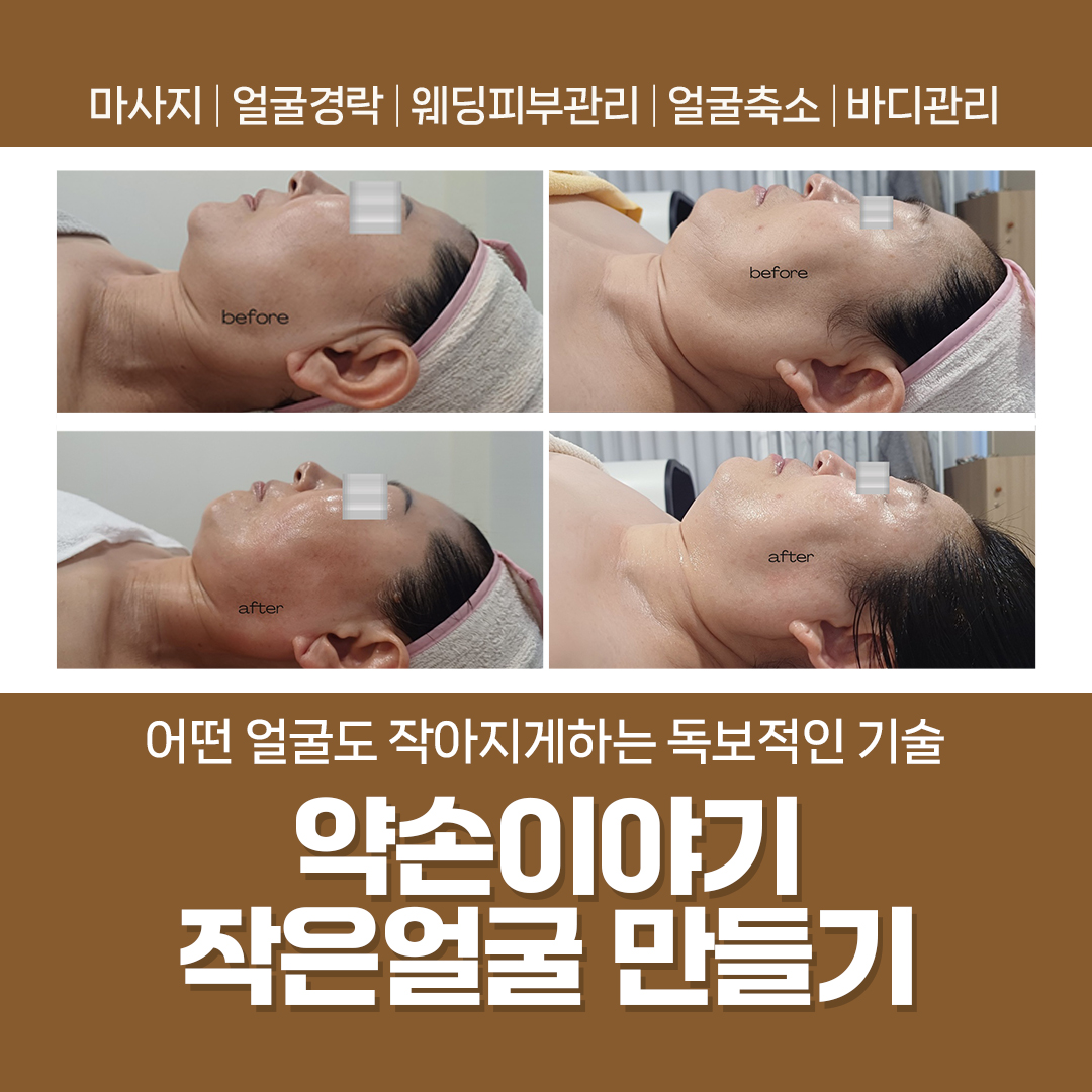 약손이야기 작은얼굴만들기 photo 3