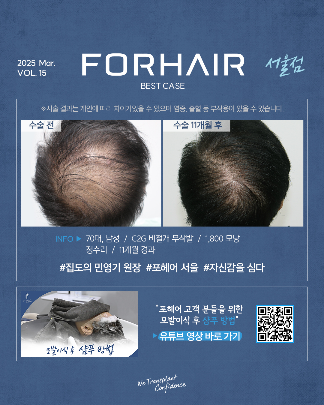 포헤어의원 서울점 대표 이미지