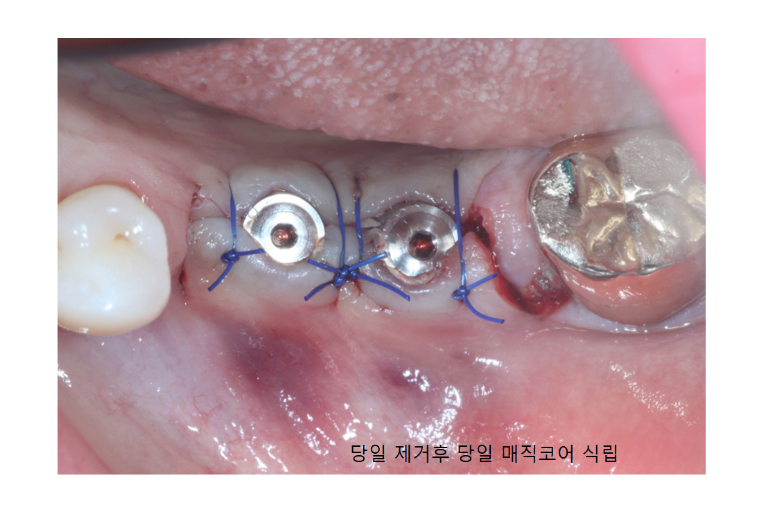 덴타피아치과의원