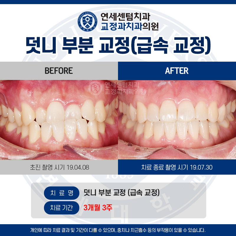연세센텀치과교정과치과의원 대표 이미지