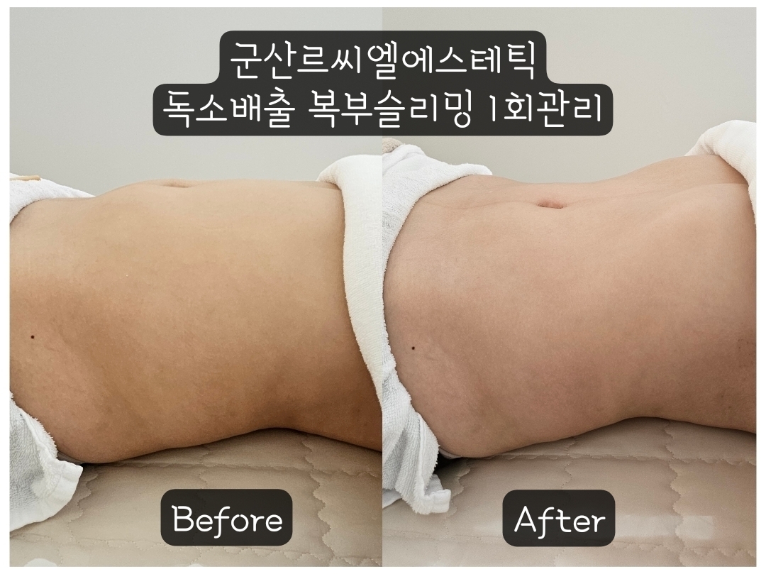 르씨엘에스테틱