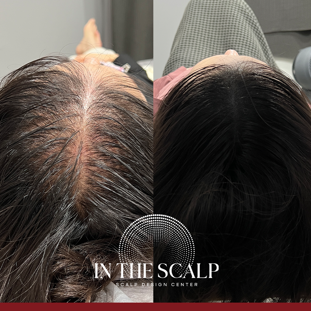 인더스칼프 당진송악점 대표 이미지