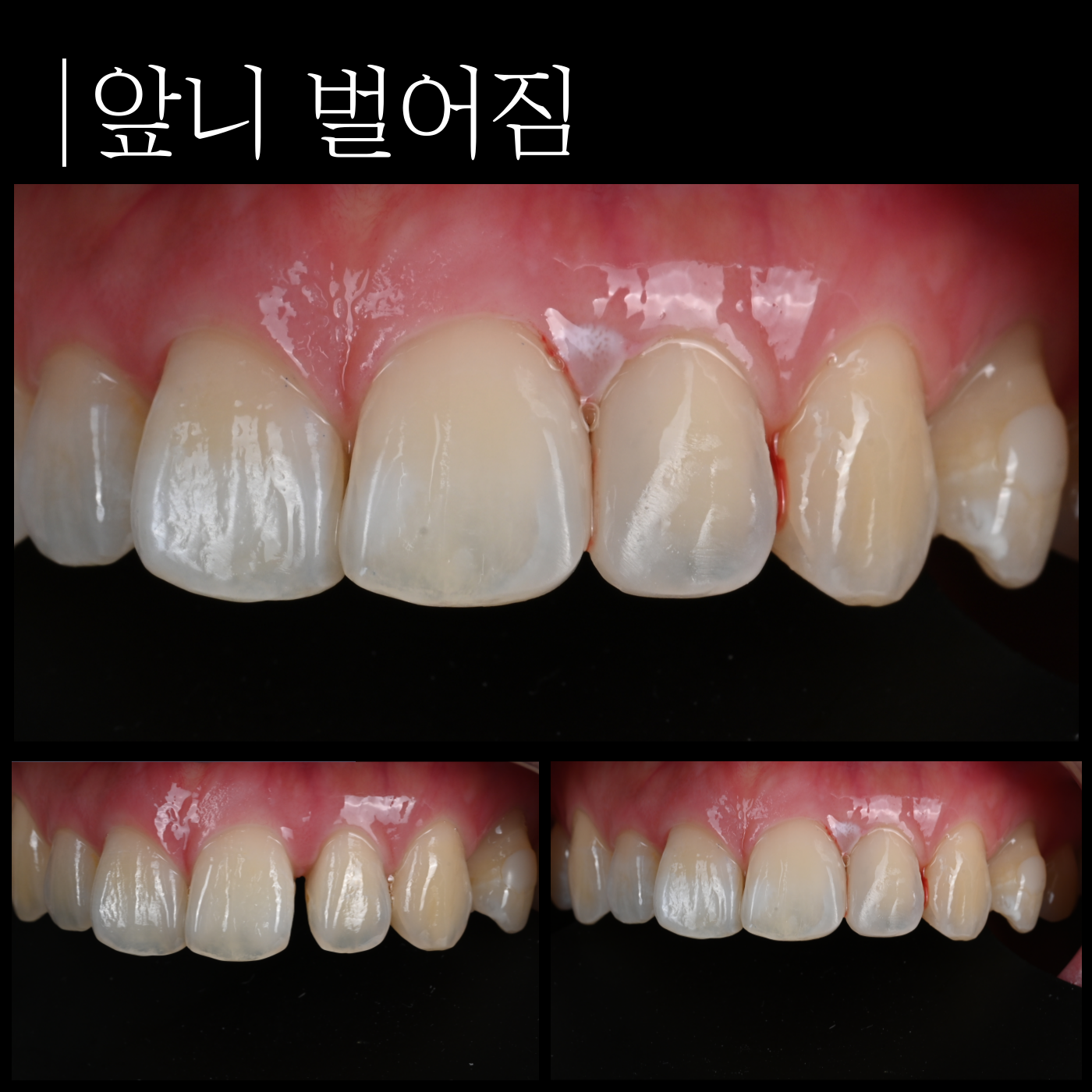 레진치과의원 대표 이미지