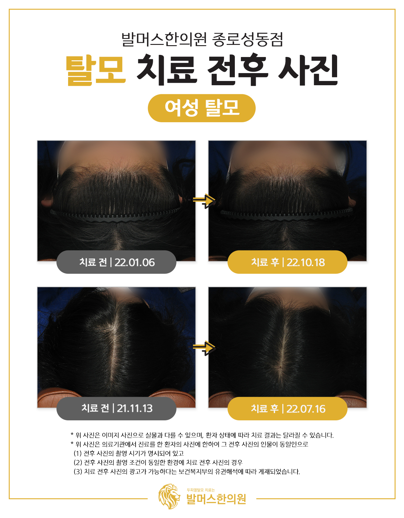 발머스한의원 종로성동 대표 이미지