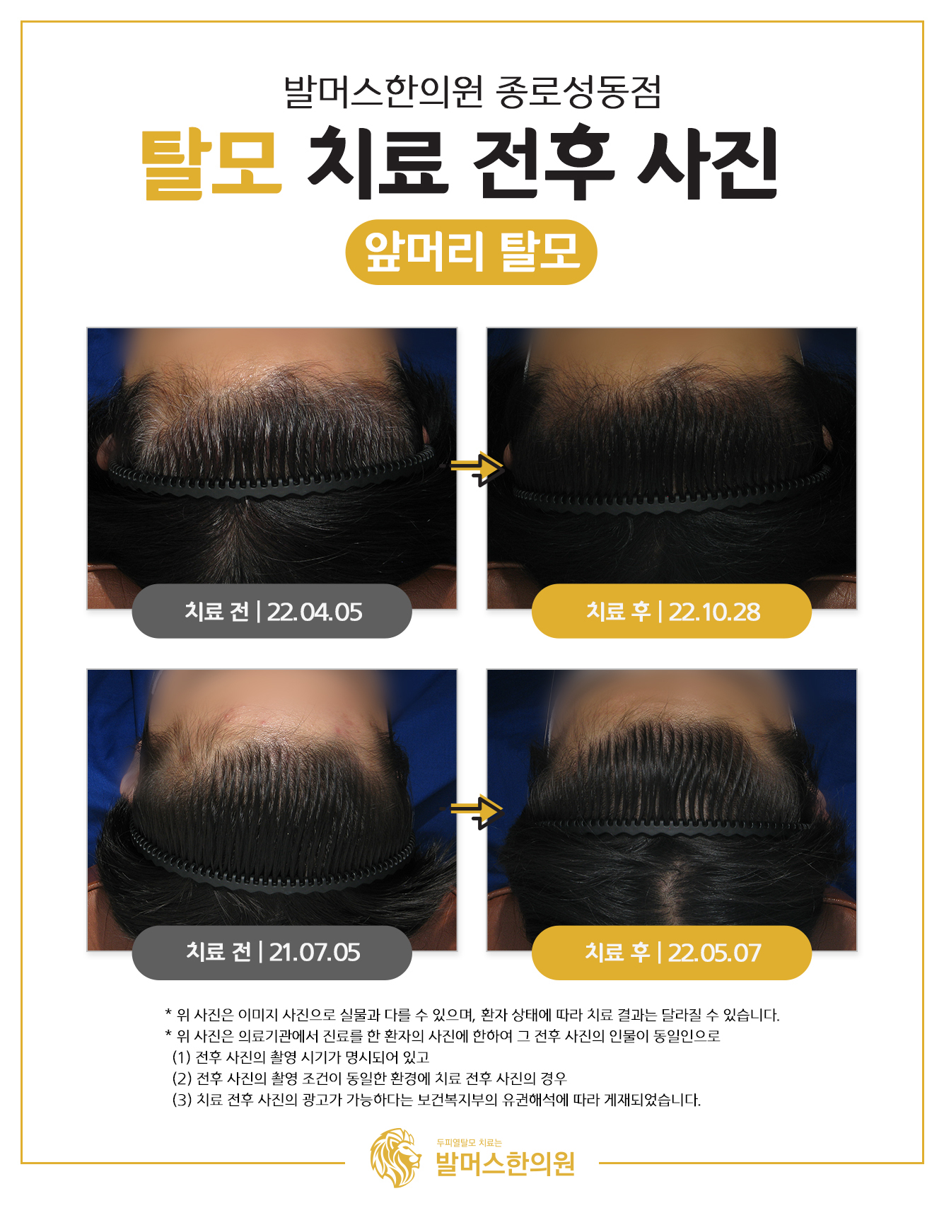 발머스한의원 종로성동 대표 이미지