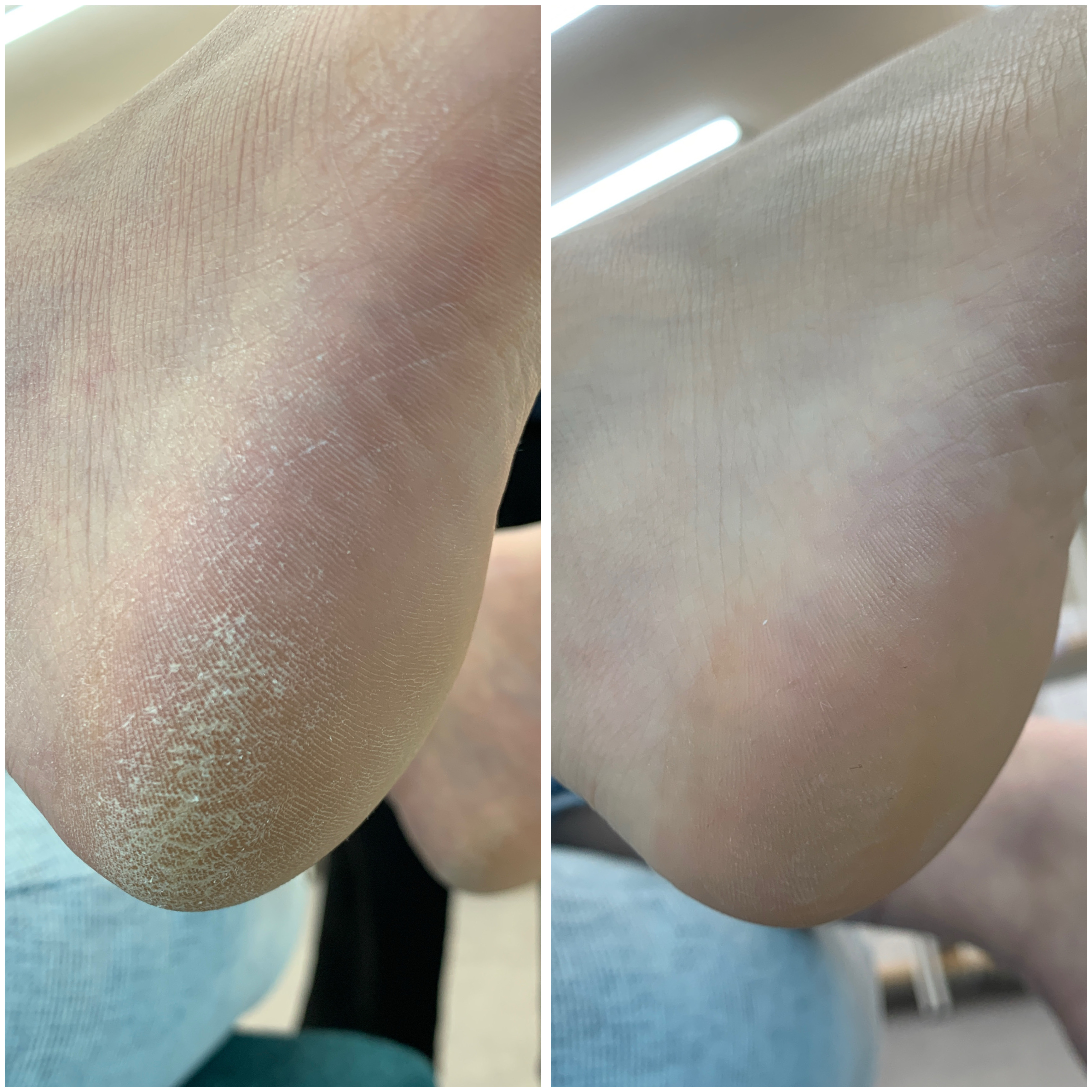 스페이스 블링 대표 이미지