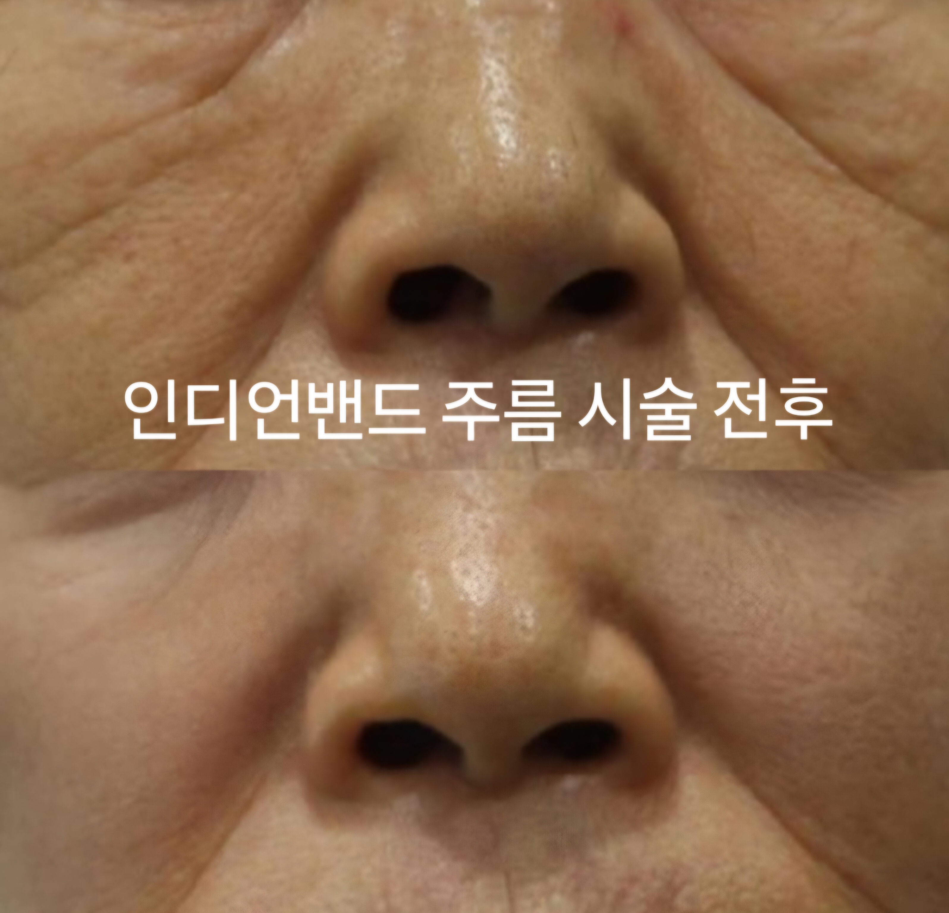 삼성비앤에스의원 강남