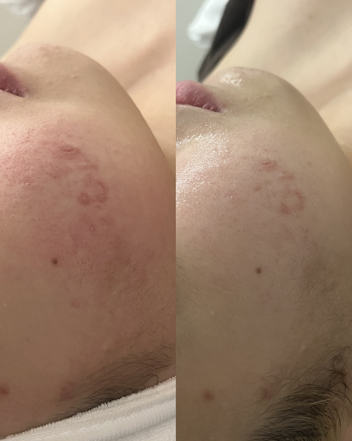 하루온 photo 6
