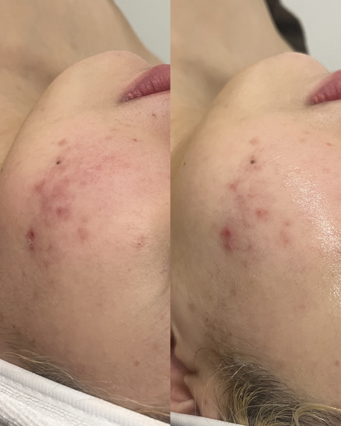 하루온 photo 5