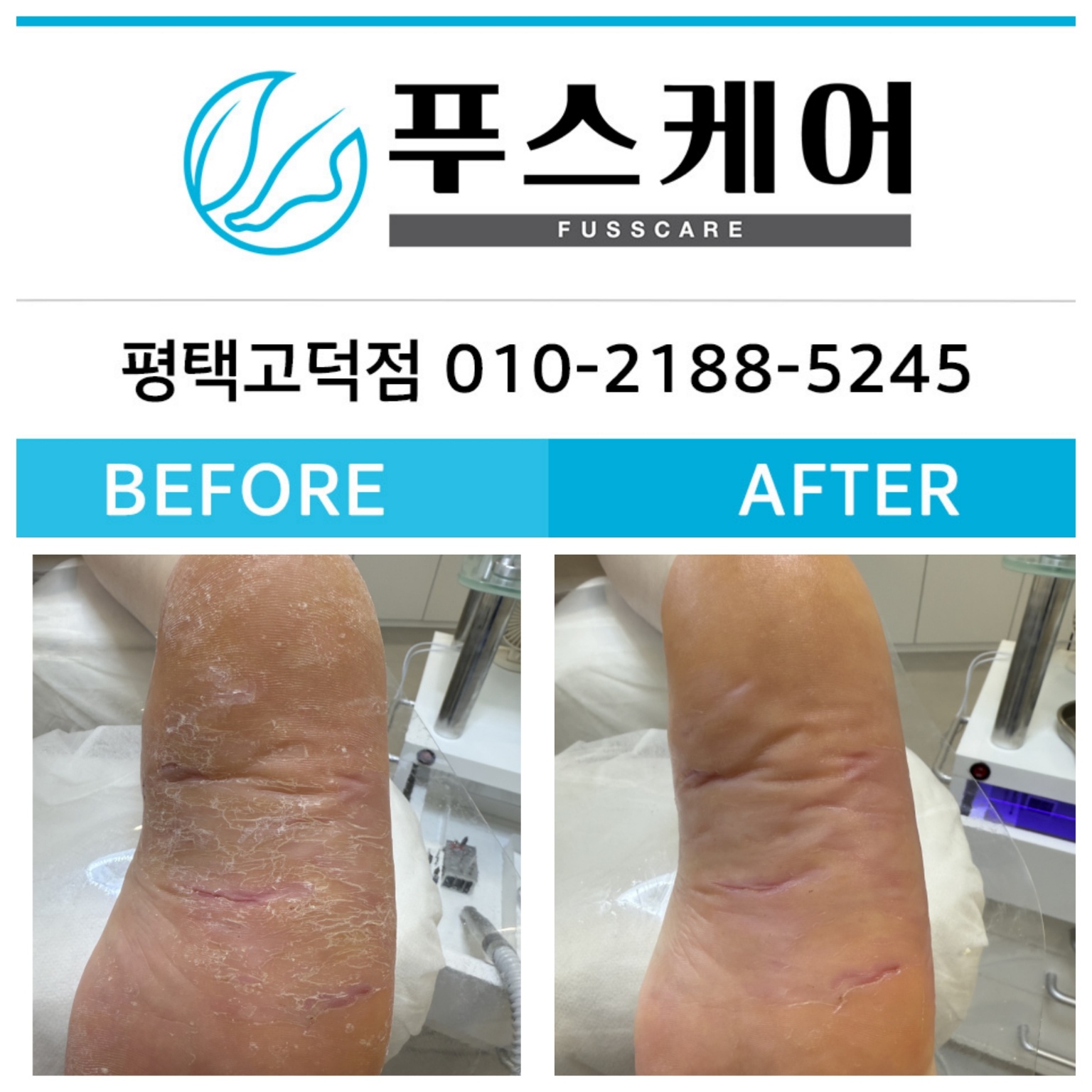 푸스케어 평택고덕점