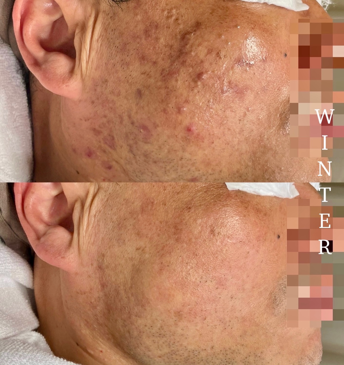 윈터에스테틱 대표 이미지