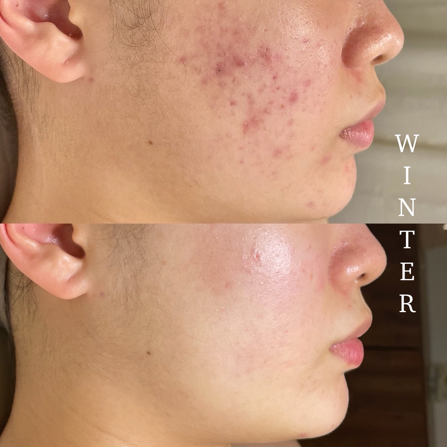 윈터에스테틱 대표 이미지