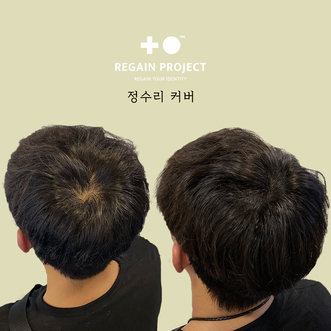 리게인프로젝트 대표 이미지