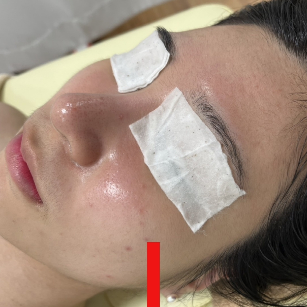 임소현 피부관리 대표 이미지