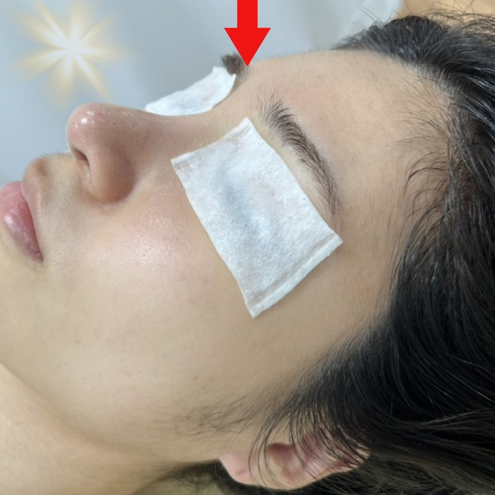 임소현 피부관리 대표 이미지