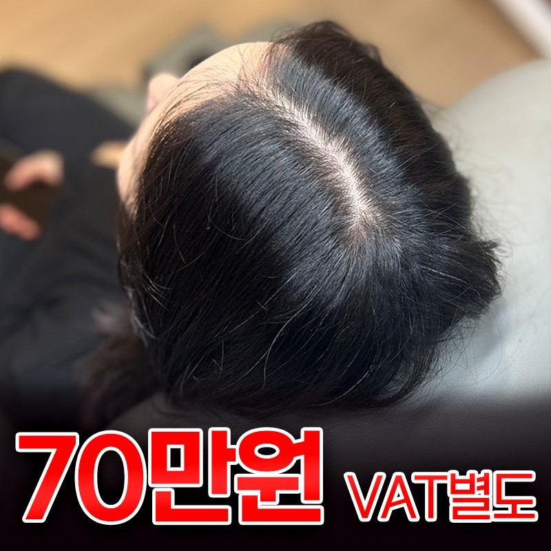 전주W한방병원 두피문신센터 대표 이미지