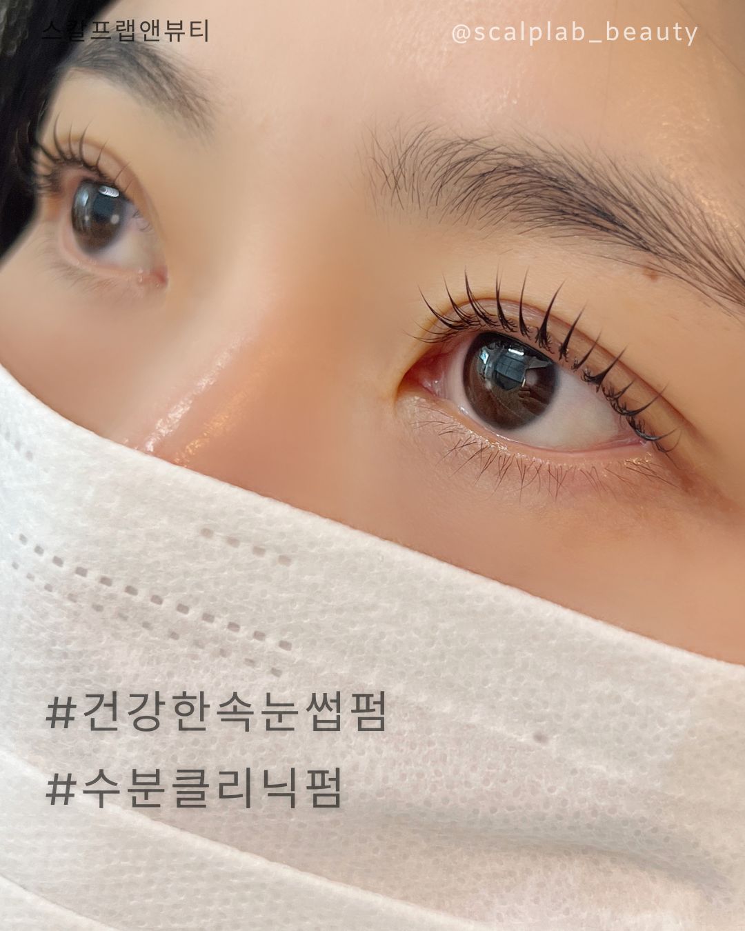 스칼프랩앤뷰티 속눈썹&눈썹&탈모 의정부점