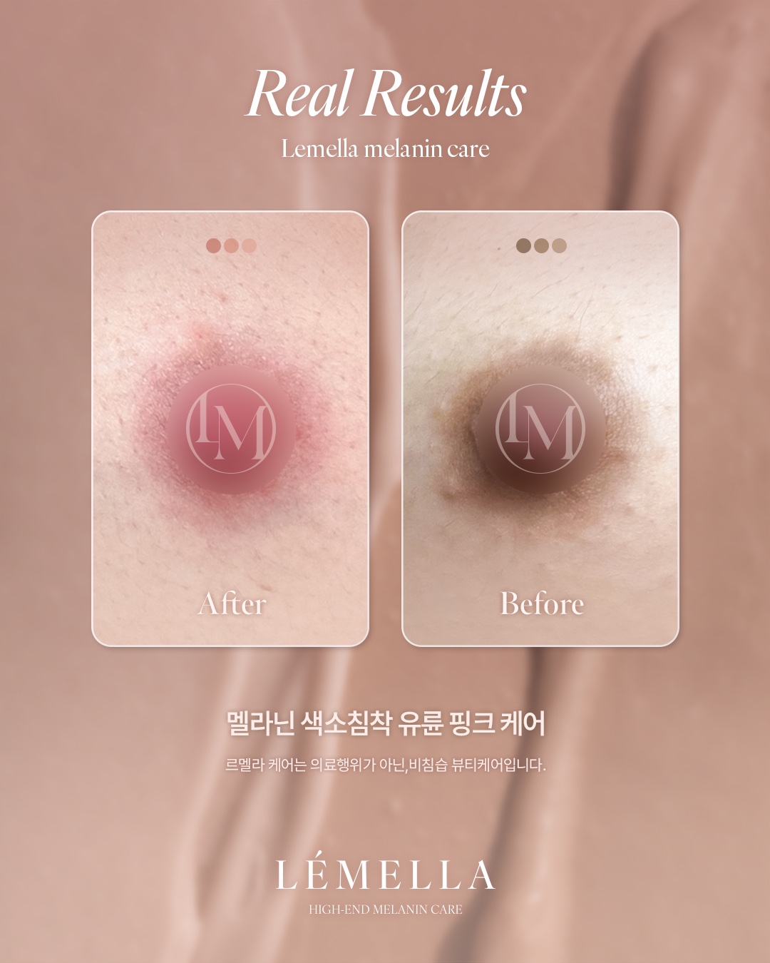 어보브나인 X 르멜라 대표 이미지
