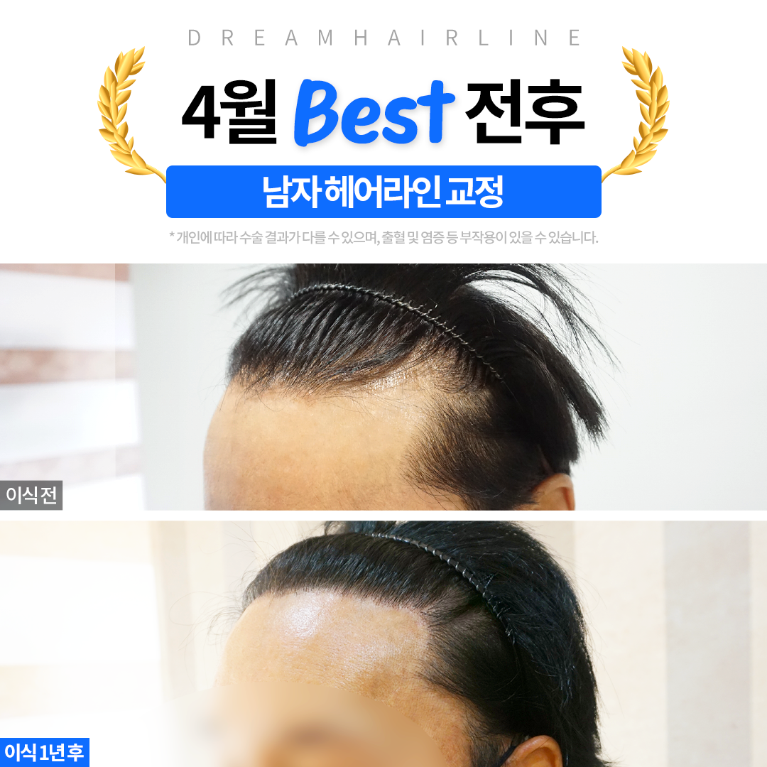 드림헤어라인의원 대표 이미지