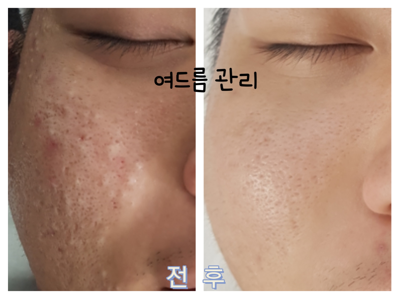 엘라뷰티 photo 3