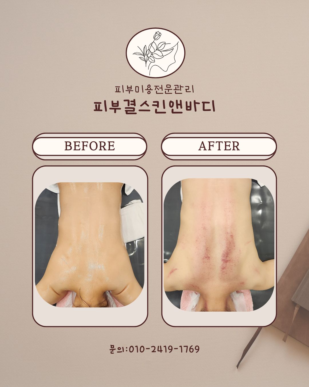 피부결스킨앤바디