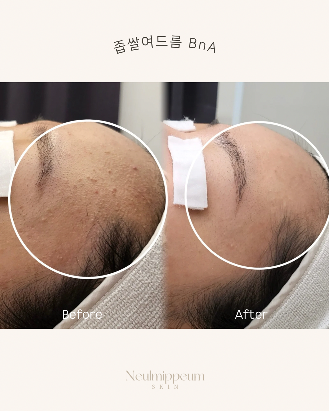 늘미쁨스킨 대표 이미지