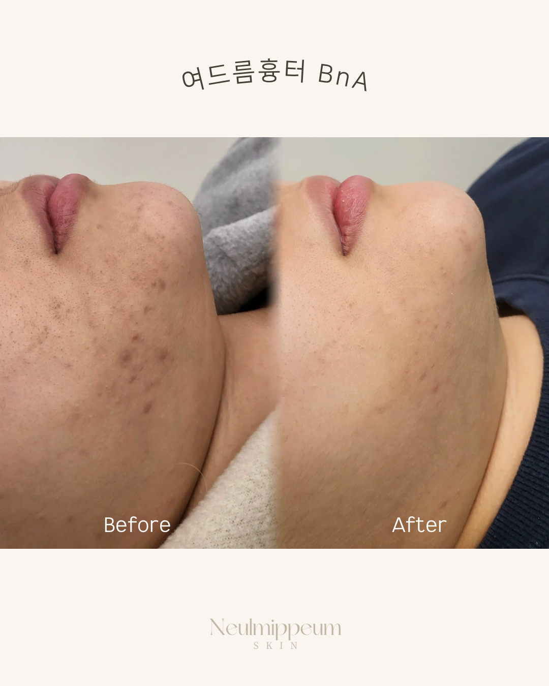 늘미쁨스킨 대표 이미지