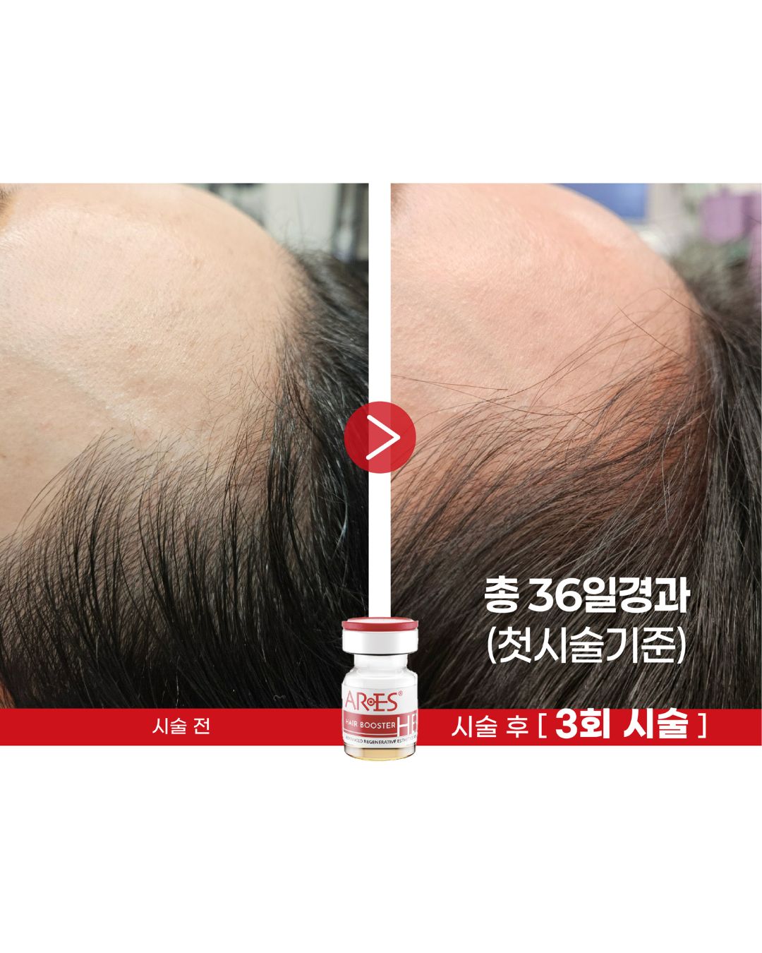 푸리네일 대표 이미지