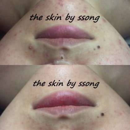 더 스킨 피부관리 대표 이미지