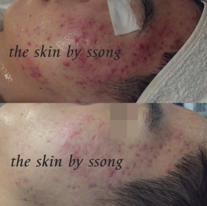 더 스킨 피부관리 대표 이미지