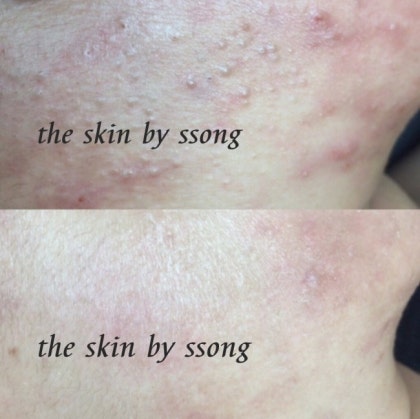 더 스킨 대표 이미지