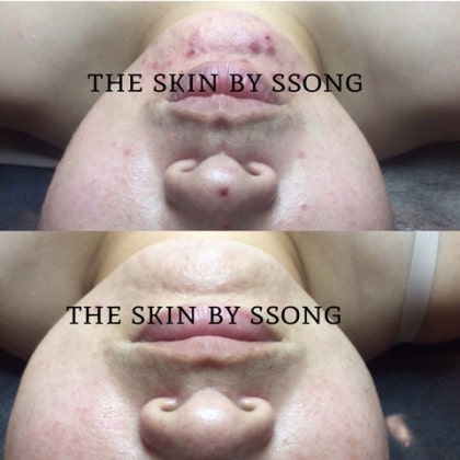 더 스킨 피부관리 대표 이미지