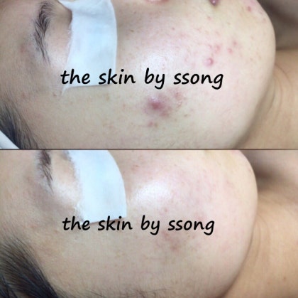 더 스킨 피부관리 대표 이미지