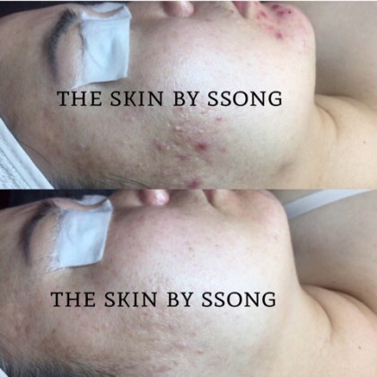 더 스킨 피부관리 대표 이미지