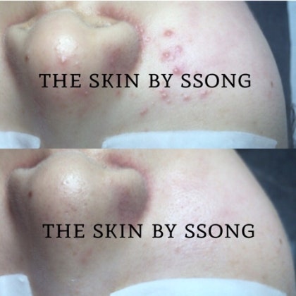 더 스킨 피부관리 대표 이미지