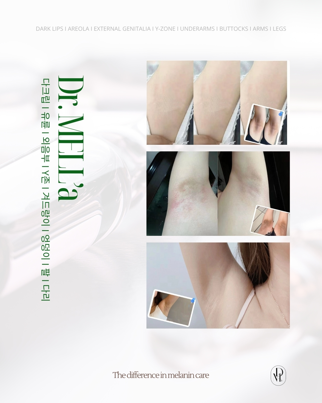 더린뷰티왁싱 부산서면점