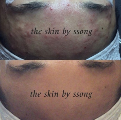 더 스킨 피부관리 대표 이미지