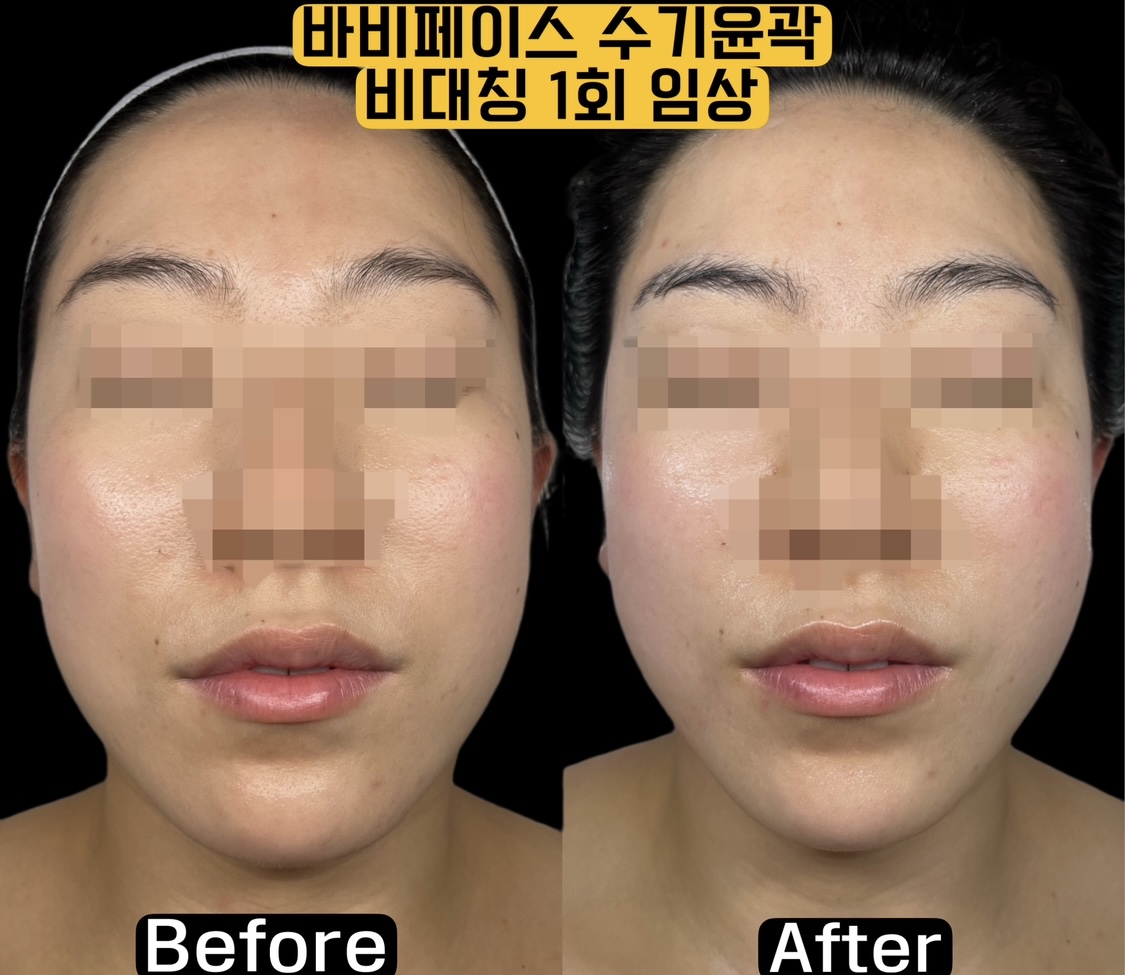 오늘피부 송파점 대표 이미지