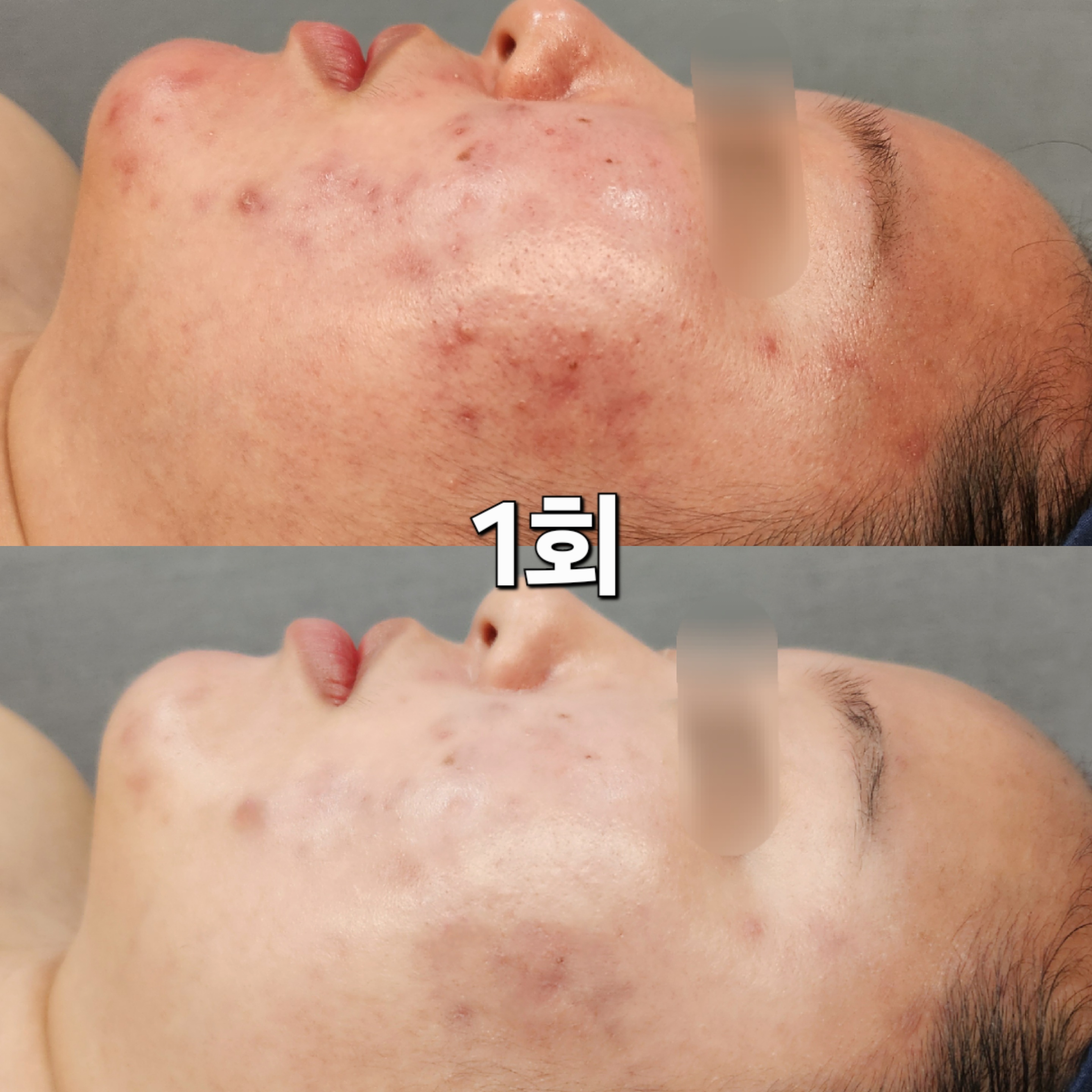 차크란 에스테틱 대표 이미지