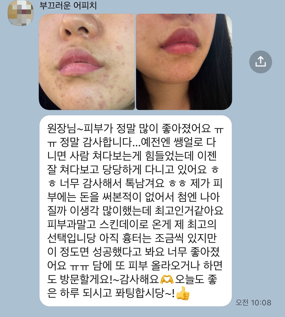 스킨데이 대표 이미지