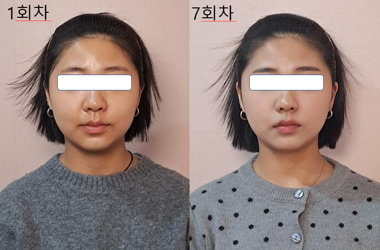 창조 페이스바디 대표 이미지