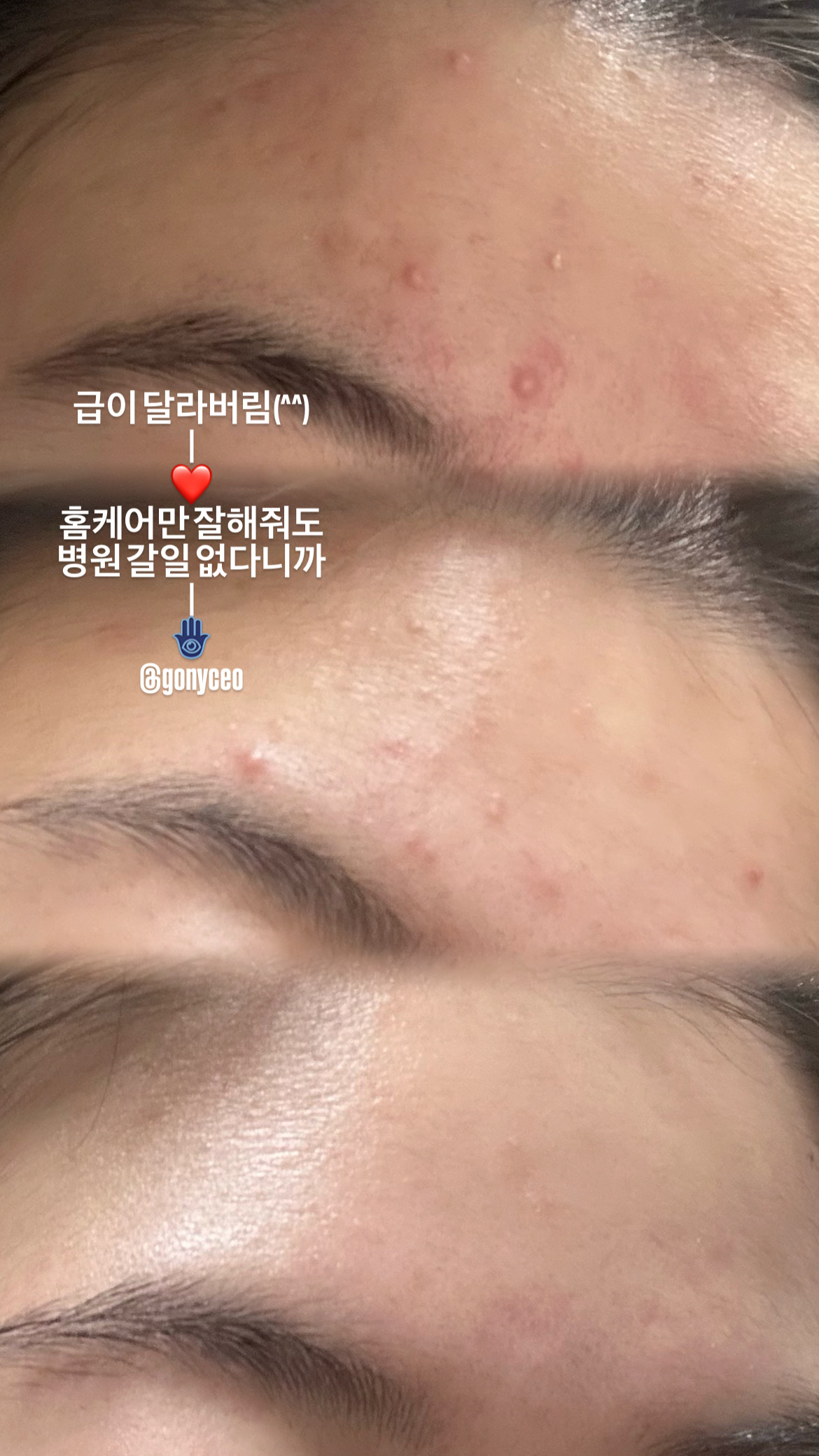 뷰티더고은 스킨앤바디