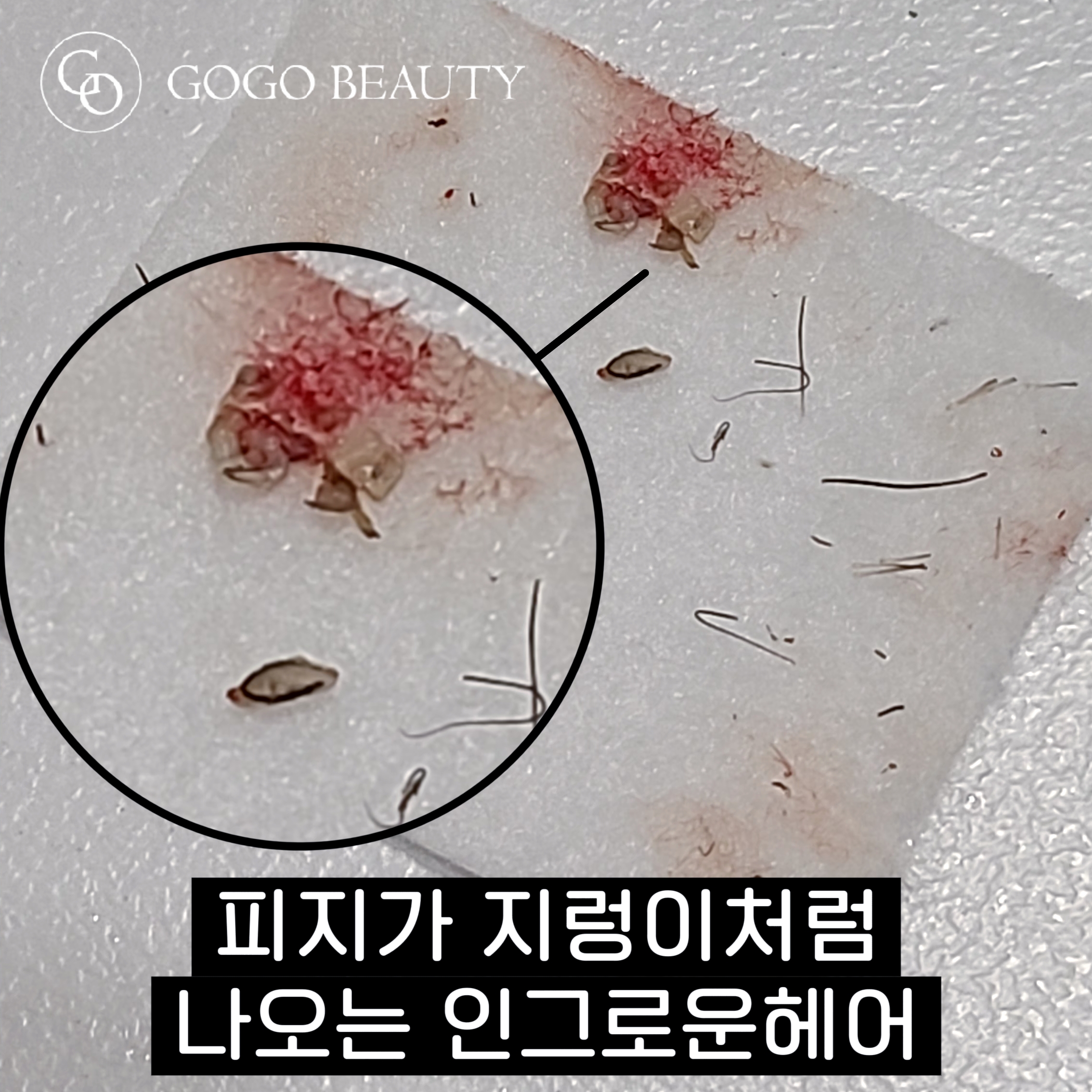 고고뷰티 왁싱피부 건대점 대표 이미지