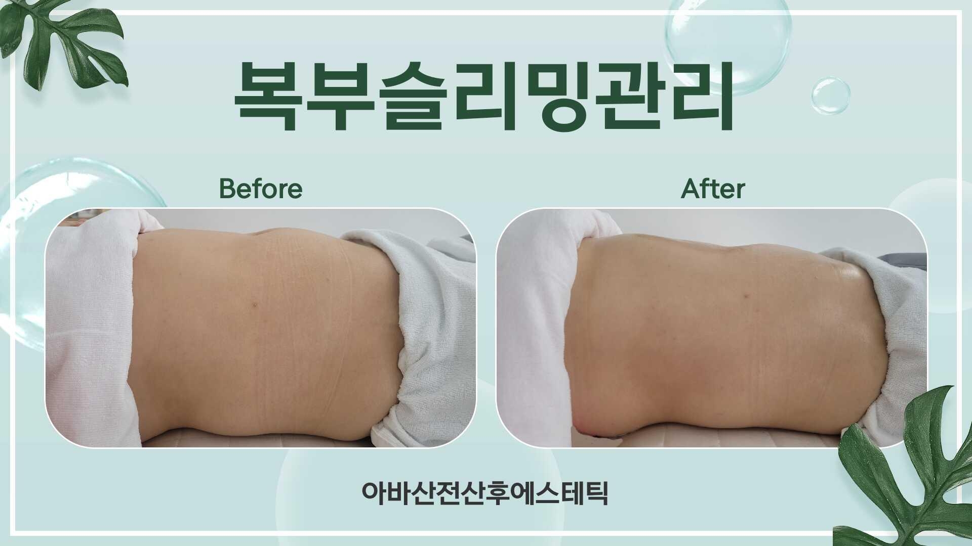 아바산전산후에스테틱 대표 이미지