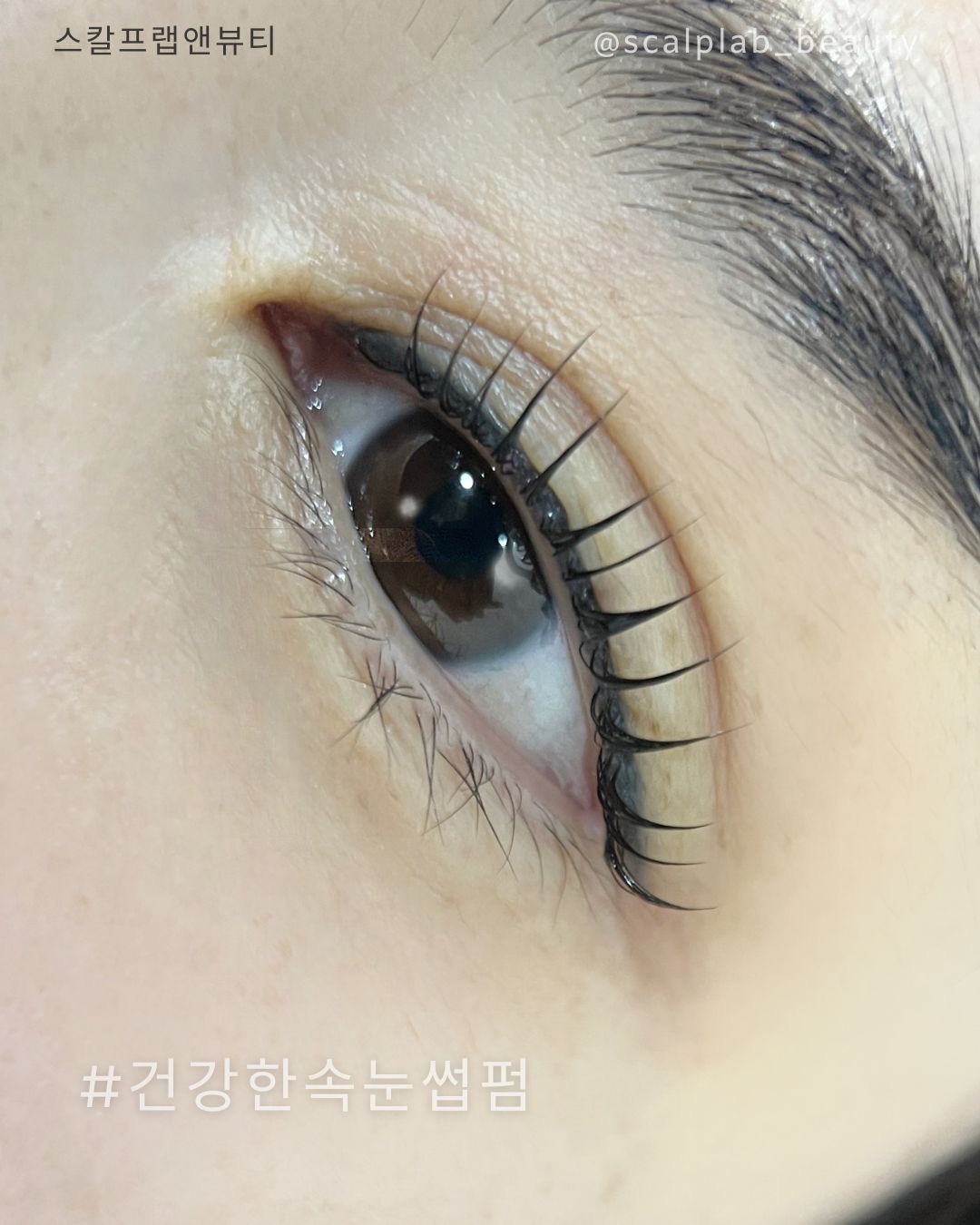 스칼프랩앤뷰티 속눈썹&눈썹&탈모 의정부점