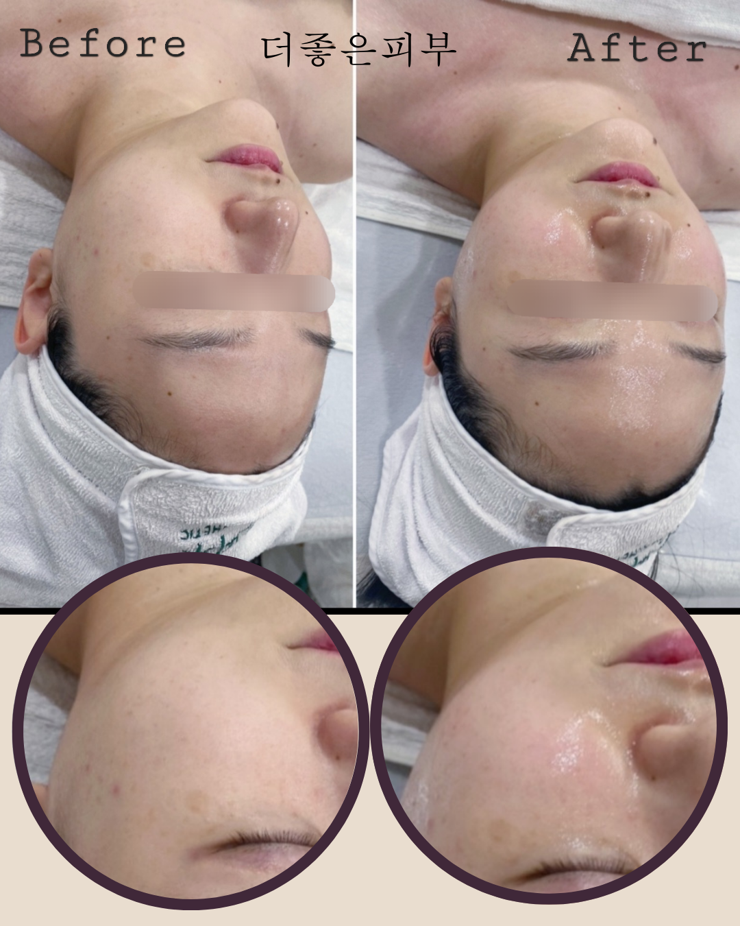 더좋은피부